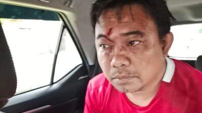 Ketum KNPI Haris Pertama Babak Belur Dikeroyok Orang Tak Dikenal