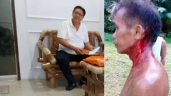 Jadi Tersangka Penganiayaan, FJS alias Sampakang, Legislator Sangihe dari Gerindra Bebas Cuci Mata di Mantos